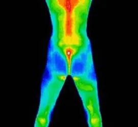 thermograpgy image